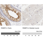 Anti-RIMBP3 Antibody