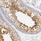 Immunohistochemical staining of human testis shows membranous and cytoplasmic positivity in spermatocytes and spermatids.