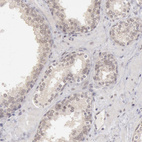 Anti-RIMBP3 Antibody