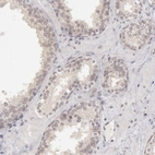 Immunohistochemical staining of human prostate shows no positivity in glandular cells as expected.