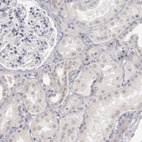 Anti-RIMBP3 Antibody