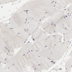 Immunohistochemical staining of human skeletal muscle shows no positivity as expected.