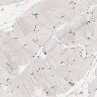 Immunohistochemical staining of human skeletal muscle shows no positivity as expected.