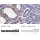 Anti-MAGEB1 Antibody