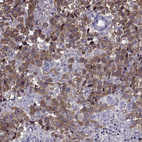 Anti-MAGEB1 Antibody