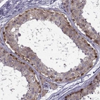 Immunohistochemical staining of human testis shows strong cytoplasmic and nuclear positivity in spermatogonia.