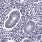 Immunohistochemical staining of human endometrium shows no positivity in glandular cells as expected.