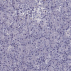 Immunohistochemical staining of human pancreas shows no positivity in exocrine glandular cells as expected.