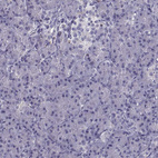 Anti-MAGEB1 Antibody