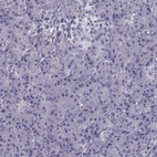 Immunohistochemical staining of human pancreas shows no positivity in exocrine glandular cells as expected.