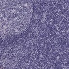 Immunohistochemical staining of human tonsil shows no positivity in lymphoid cells as expected.
