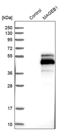 Western blot analysis in control (vector only transfected HEK293T lysate) and MAGEB1 over-expression lysate (Co-expressed with a C-terminal myc-DDK tag (~3.1 kDa) in mammalian HEK293T cells, LY406154).