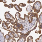 Anti-AMOTL1 Antibody