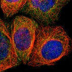 Anti-AMOTL1 Antibody