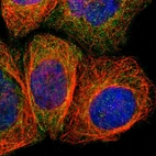 Immunofluorescent staining of human cell line A-431 shows localization to cytosol & cell junctions.