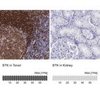 Anti-BTK Antibody