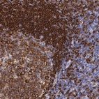Immunohistochemical staining of human tonsil shows strong membranous positivity in non-germinal center cells.