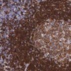 Immunohistochemical staining of human lymph node shows strong membranous positivity in non-germinal center cells.