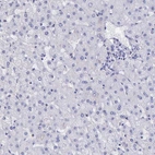 Immunohistochemical staining of human liver shows no positivity in hepatocytes as expected.