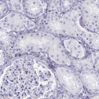 Immunohistochemical staining of human kidney shows no positivity in cells in tubules as expected.