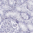 Immunohistochemical staining of human kidney shows no positivity in cells in tubules as expected.