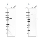 Western blot analysis using Anti-BTK antibody HPA001198 (A) shows similar pattern to independent antibody HPA002028 (B).