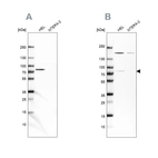 Western blot analysis using Anti-BTK antibody HPA001198 (A) shows similar pattern to independent antibody HPA002028 (B).