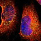 Immunofluorescent staining of human cell line U-251 MG shows localization to vesicles.