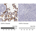 Anti-EGFR Antibody