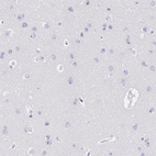 Immunohistochemical staining of human cerebral cortex shows no positivity in neurons as expected.