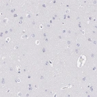 Immunohistochemical staining of human cerebral cortex shows no positivity in neurons as expected.