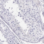 Immunohistochemical staining of human testis shows no in cells in seminiferous ducts as expected.