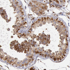 Anti-RNF139 Antibody