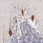 Immunohistochemical staining of human cerebellum shows strong cytoplasmic positivity in Purkinje cells.