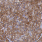 Anti-RNF139 Antibody