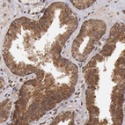 Anti-STX17 Antibody