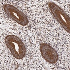 Immunohistochemical staining of human endometrium shows strong cytoplasmic positivity in glandular cells.