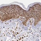 Immunohistochemical staining of human skin shows moderate cytoplasmic positivity in epidermal cells.