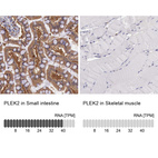 Anti-PLEK2 Antibody