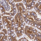 Immunohistochemical staining of human Small intestine shows strong cytoplasmic positivity in glandular cells.