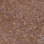 Immunohistochemical staining of human Liver shows strong cytoplasmic positivity in hepatocytes.