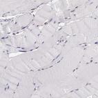 Immunohistochemical staining of human Skeletal muscle shows no positivity in myocytes as expected.
