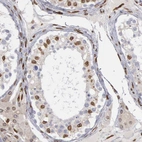 Immunohistochemical staining of human testis shows moderate to strong positivity in nuclear membrane in cells in seminiferous ducts.