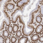 Immunohistochemical staining of human stomach shows moderate to strong positivity in nuclear membrane in glandular cells.