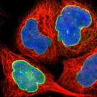 Immunofluorescent staining of human cell line A-431 shows positivity in nuclear membrane.