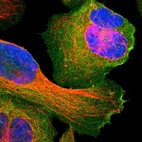 Immunofluorescent staining of human cell line U-2 OS shows localization to plasma membrane.
