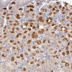 Anti-PIK3R1 Antibody