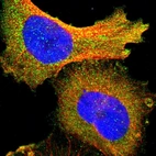 Immunofluorescent staining of human cell line U-251 MG shows localization to cytosol.
