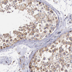 Anti-DRG1 Antibody