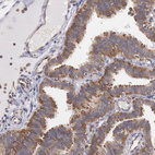 Anti-DRG1 Antibody